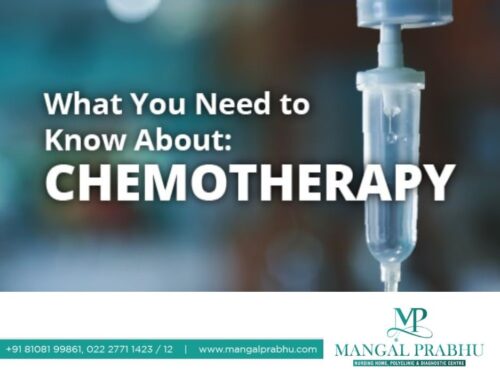 What you need to know chemotherapy?