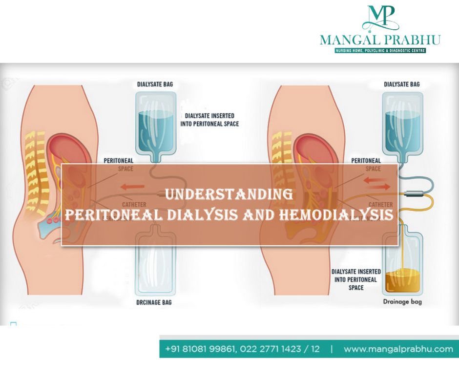 difference-between-hemodialysis-and-dialysis-mangal-prabhu-hospital