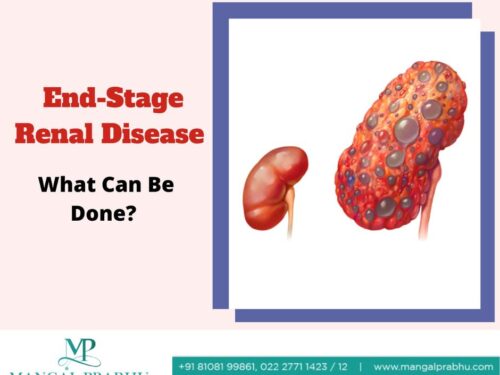 End-stage Renal Disease