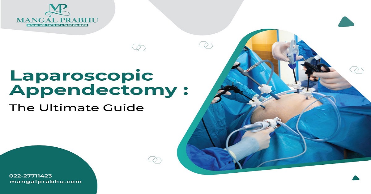 Laparoscopic Appendectomy Procedure – Mangal Prabhu Hospital