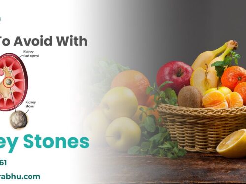 Foods To Avoid With Kidney Stones