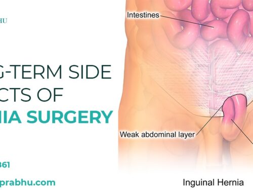 Long-term Side Effects Of Hernia Surgery
