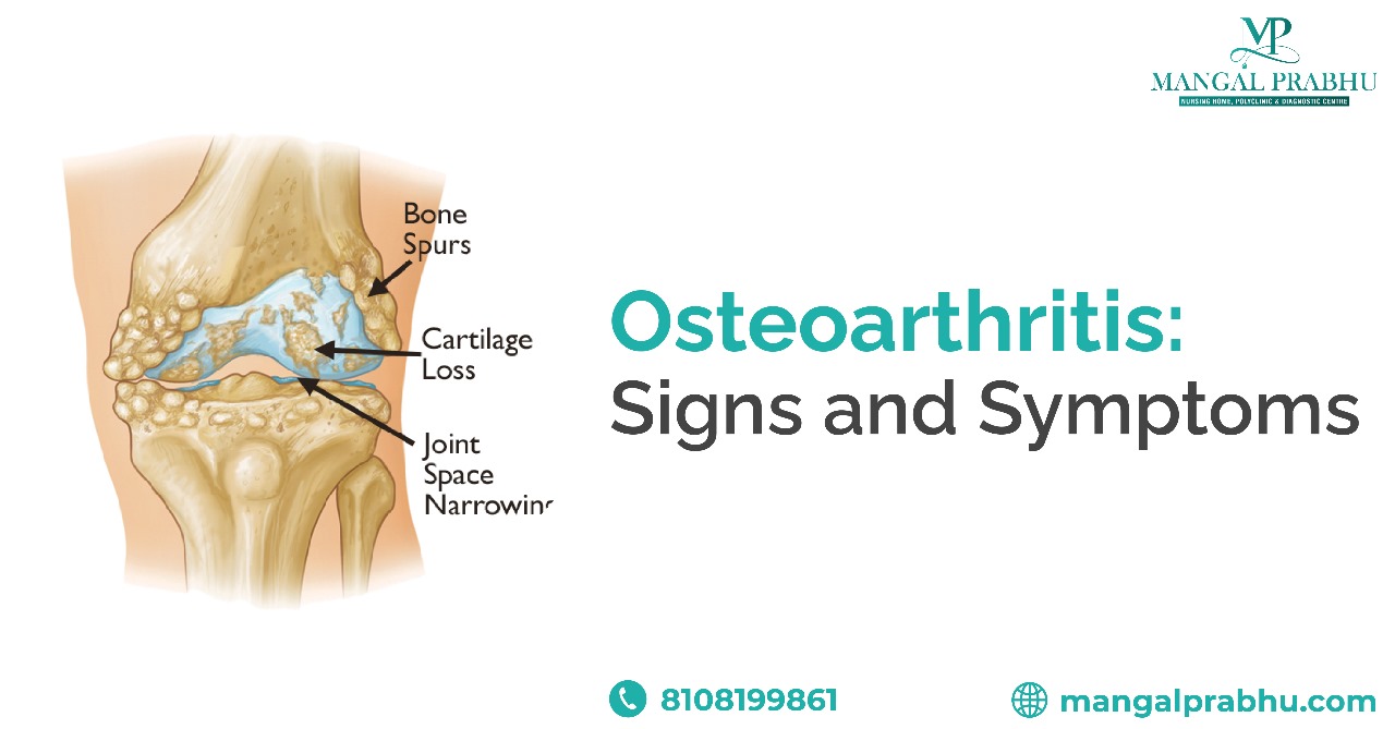 Osteoarthritis - Connecticut Orthopaedics