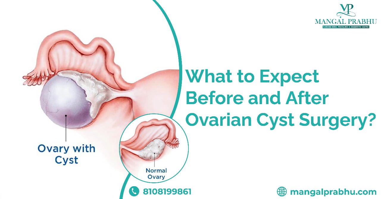 Types Of Ovarian Cysts