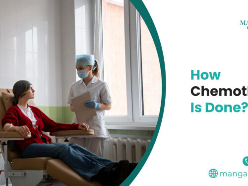 How Chemotherapy Is Done?