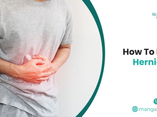 How To Relieve Hernia Pain?