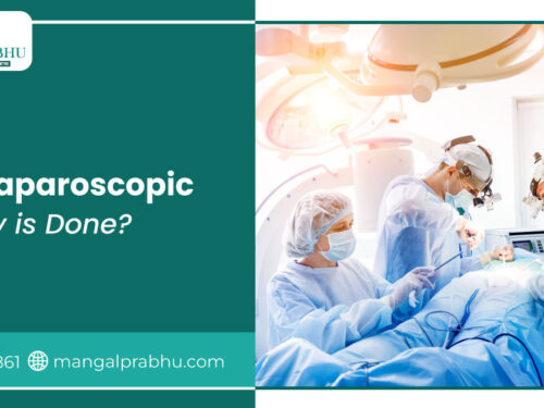 Why is Laparoscopic Surgery Done?