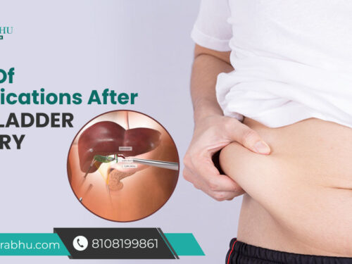 Signs Of Complications After Gallbladder Surgery