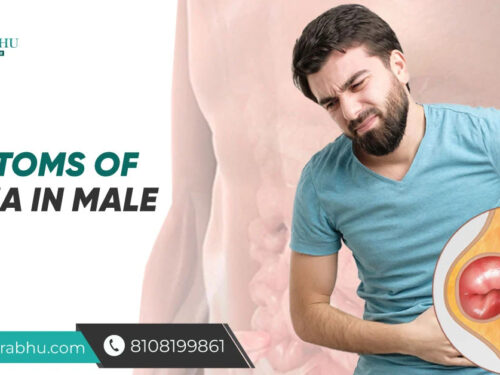 Symptoms Of Hernia In Male