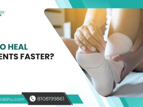 How to Heal Ligaments Faster?