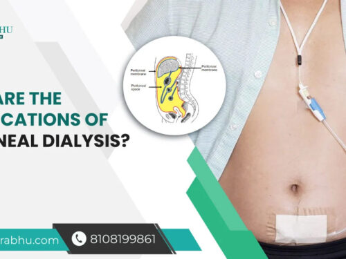 What Are the Complications of Peritoneal Dialysis?