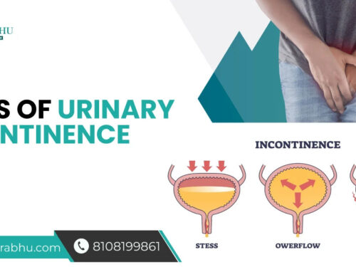 Types of Urinary Incontinence