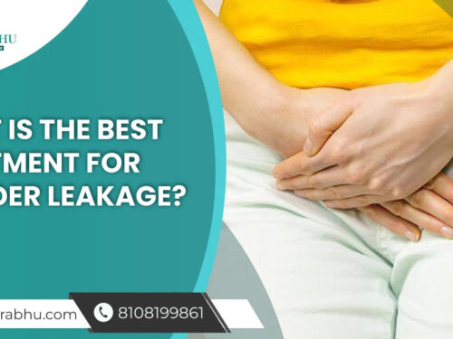 What is The Best Treatment for Bladder Leakage?