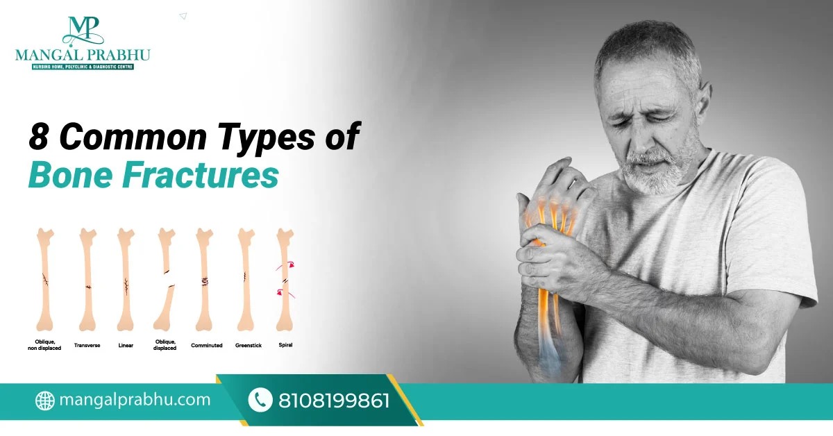 8 Types of Bone Fractures