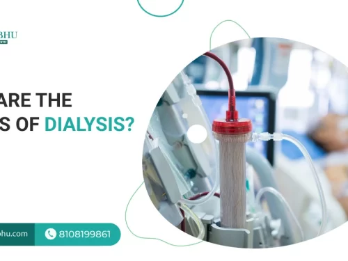 What are the 4 Types of Dialysis?