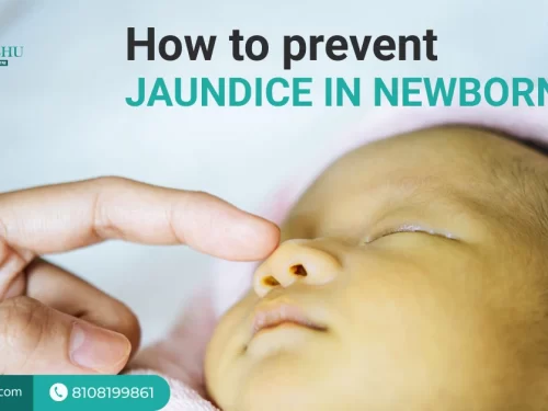 How to Prevent Jaundice in Newborns?