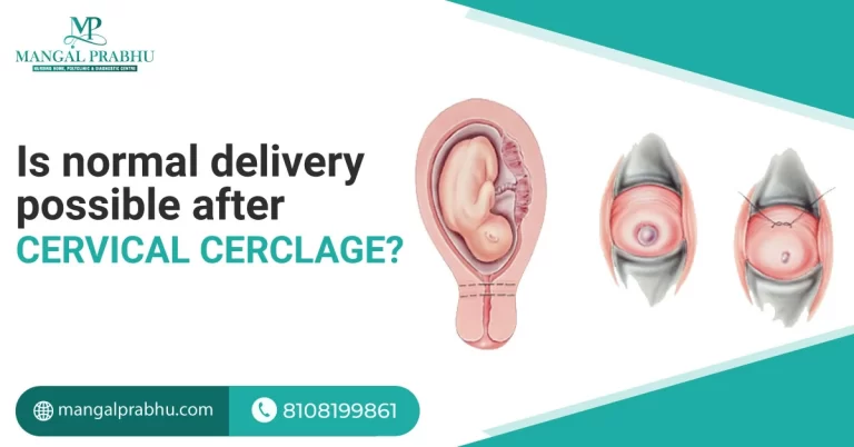 Is Normal Delivery Possible After Cervical Cerclage?
